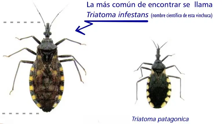 chagas
