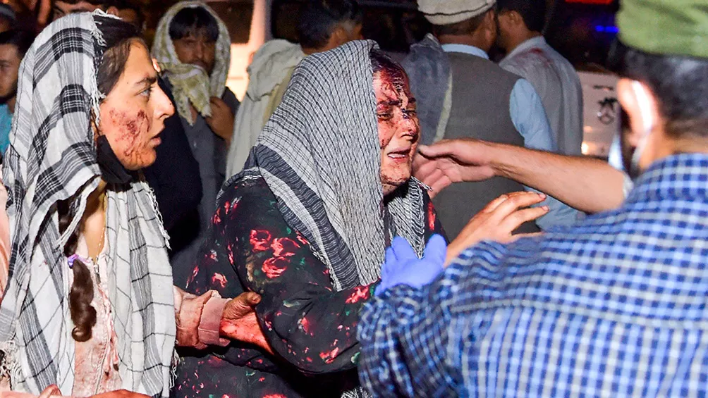 Ataque Kabul
