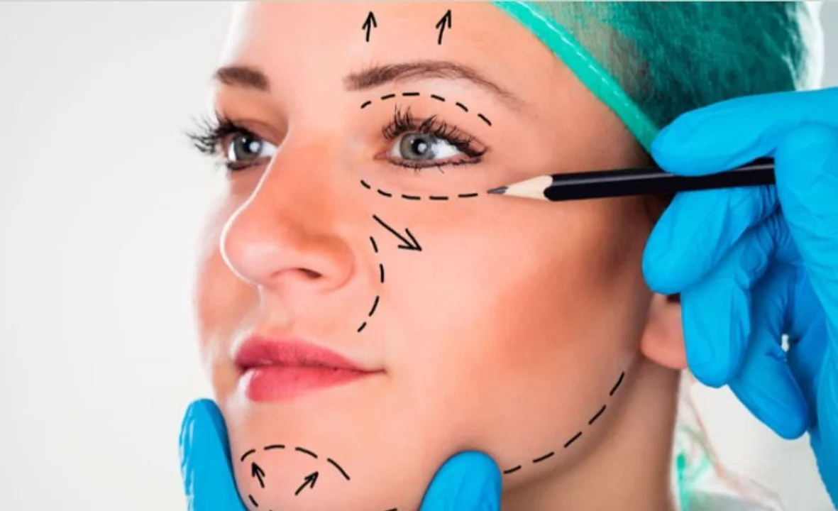 cirugia facial