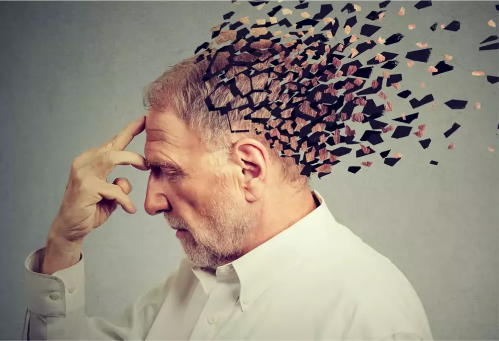Alzheimer