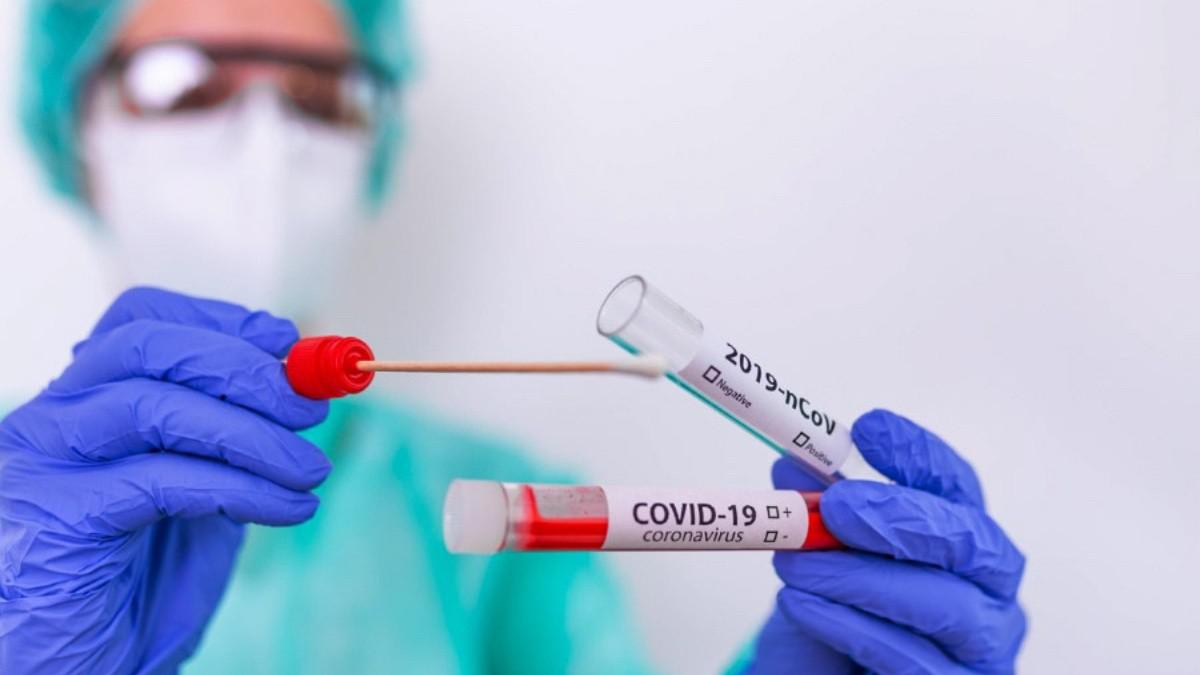 Tets de coronavirus