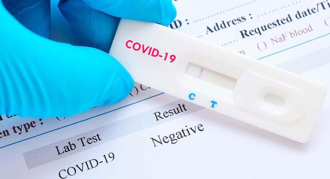 Test Covid-19