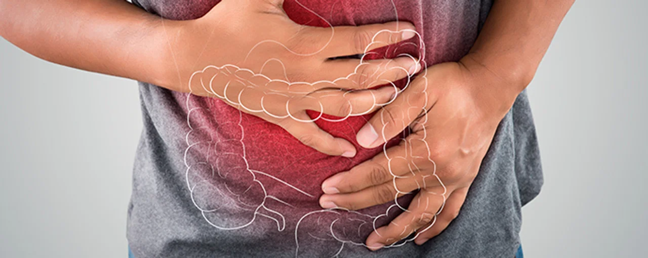 Enfermedades Inflamatorias Intestinales