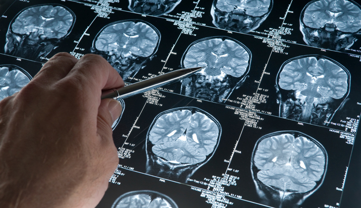 Cientificos Alzheimer
