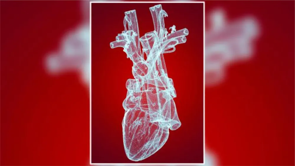 aorta